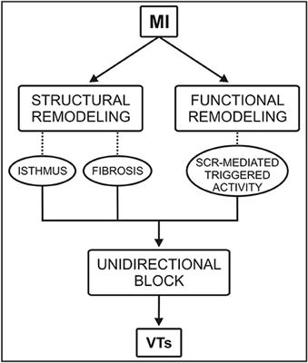 Microscopic Isthmuses and Fibrosis Within the Border Zone of Infarcted Hearts Promote Calcium-Mediated Ectopy and Conduction Block